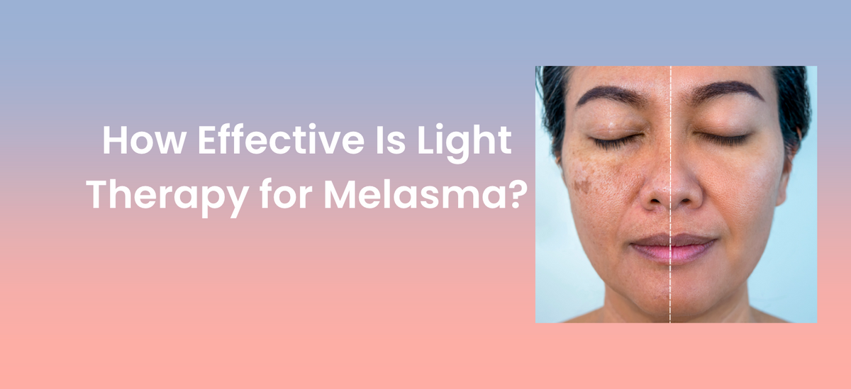 How Effective Is Light Therapy for Melasma LED Esthetics