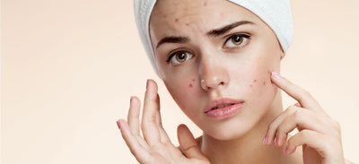How to Treat your Acne with LED Therapy (No Creams, No Gels)