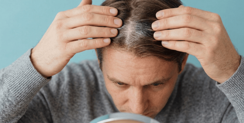 Man parting his hair and looking into a mirror to examine thinning hair on the top of his scalp.