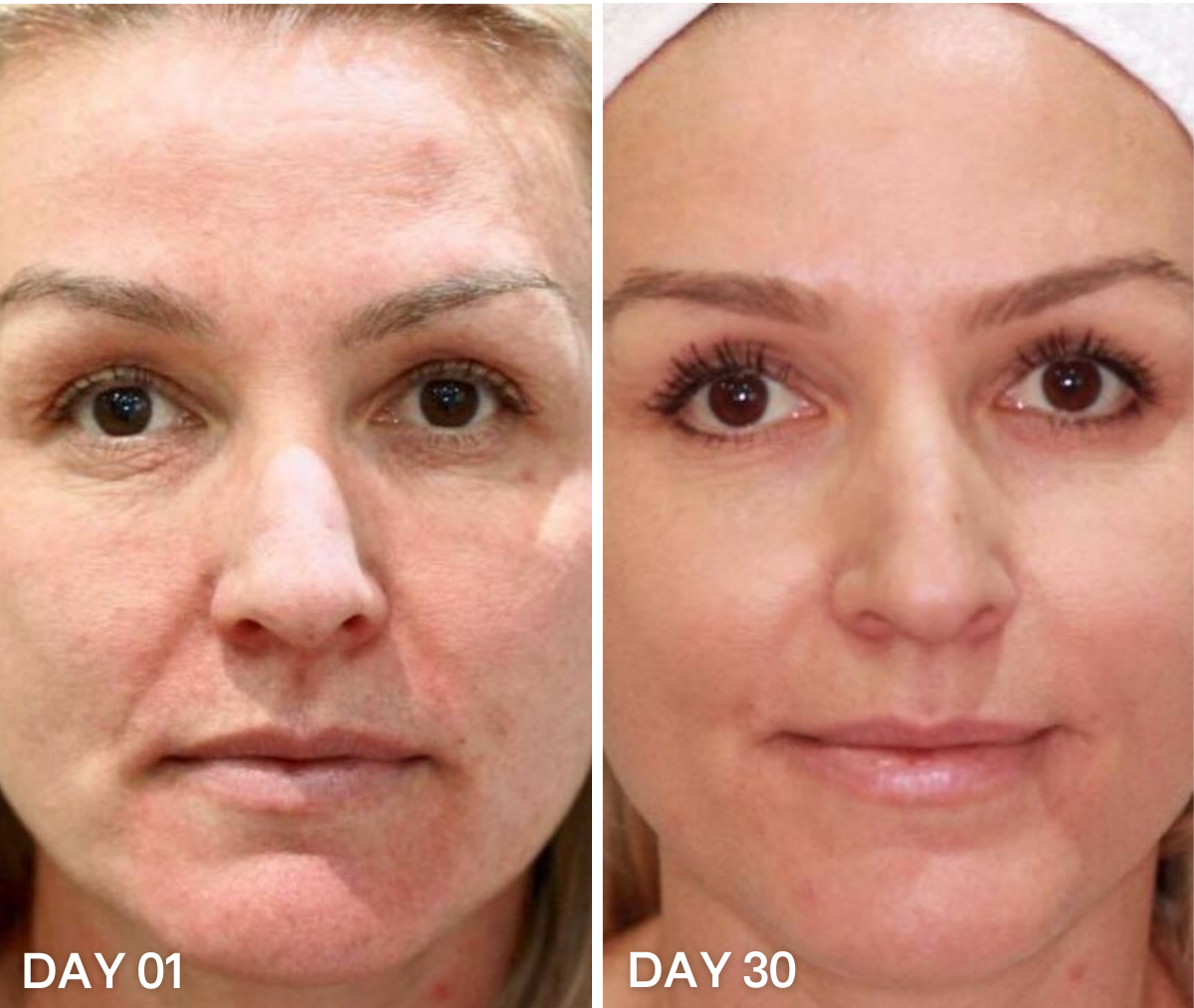 It Can Make You Look 10 Years Younger