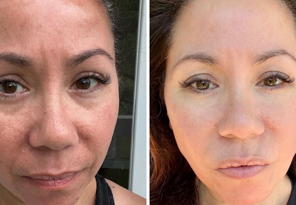 Ruby, after 4 weeks, before and after