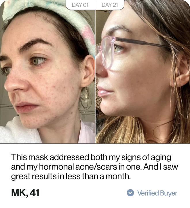 Customer before and after results