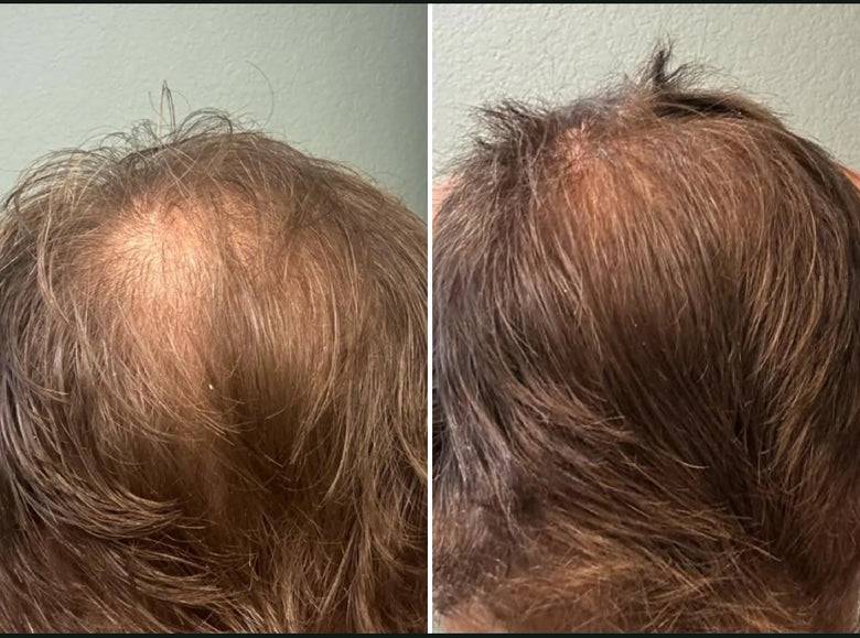 Rob, 35 before and after using Definitely thicker