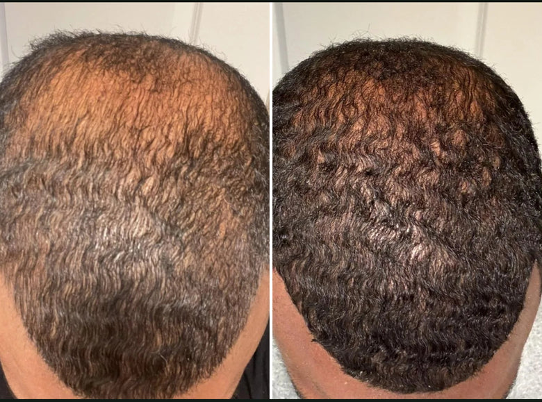 Andre, 43 before and after using It’s a game-changer