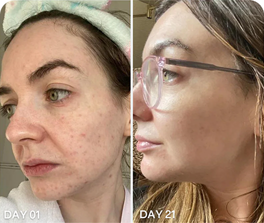 Repair Damaged Skin