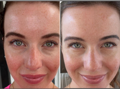 Martine, 34 before and after using Perfect for fine lines!