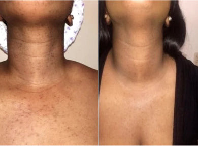 Side-by-side comparison of a person's neck with and without a necklace.