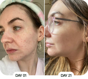 Customer before and after results