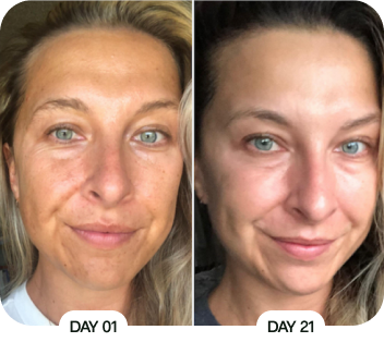 Customer before and after results