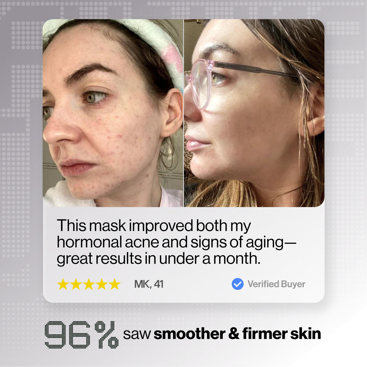 Glotech™ Mask Lite 2.0
