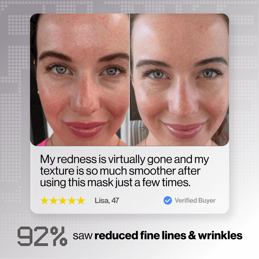 Hydrogel Mask x5