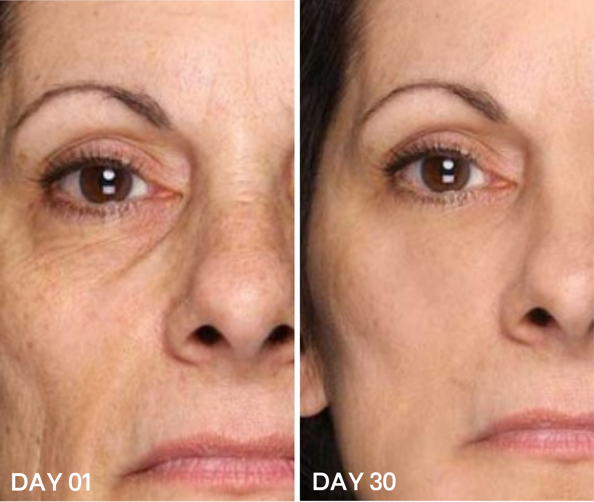 It Dramatically Reduces Fine Lines