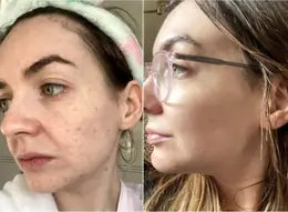 Side-by-side comparison of a woman's face with and without glasses.