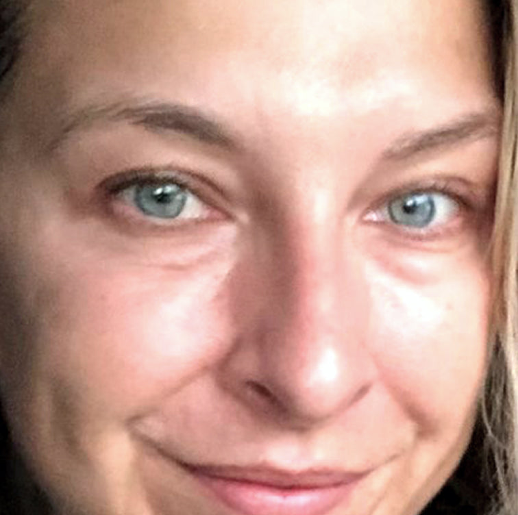 Karina, 39 after using LED Esthetics