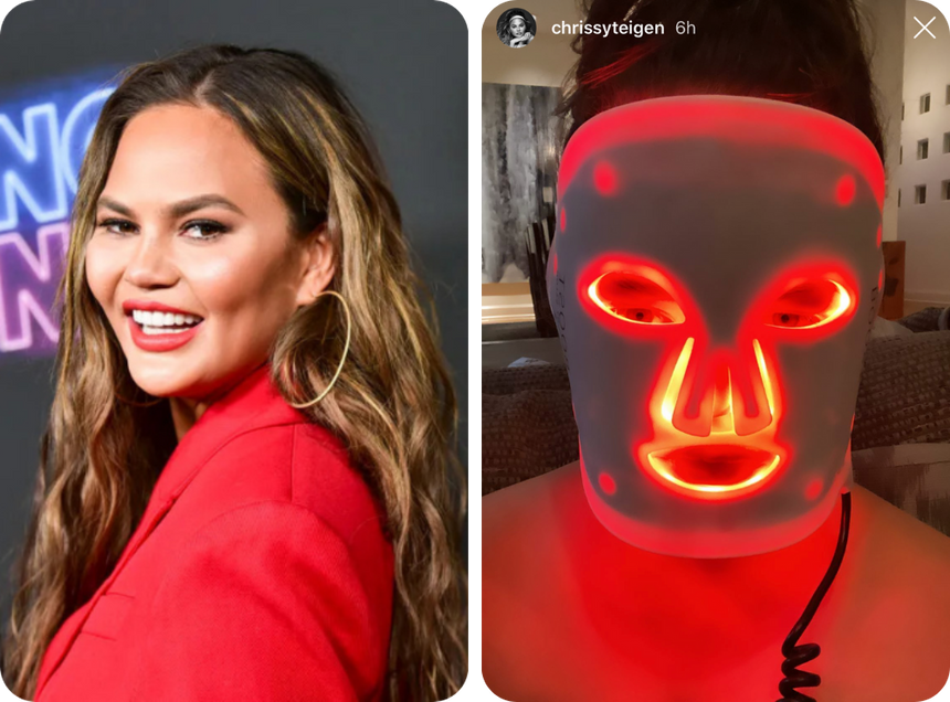 Chrissy Teigen