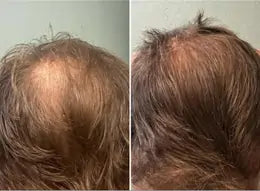Side-by-side comparison of hair before and after treatment on a person with brown hair.